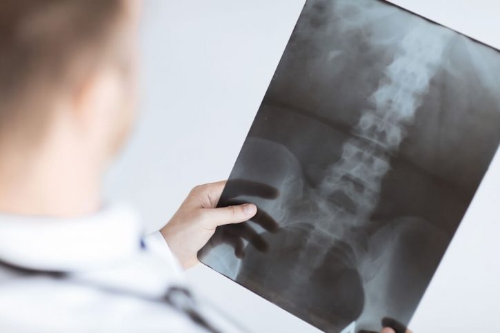 Las Vegas Spinal Injury Attorneys