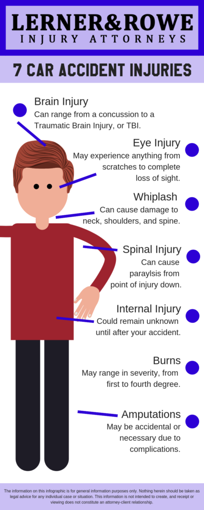 car accident attorney in Albuquerque infographic