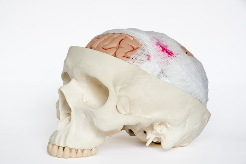 Traumatic brain injury lawyer in New Mexico