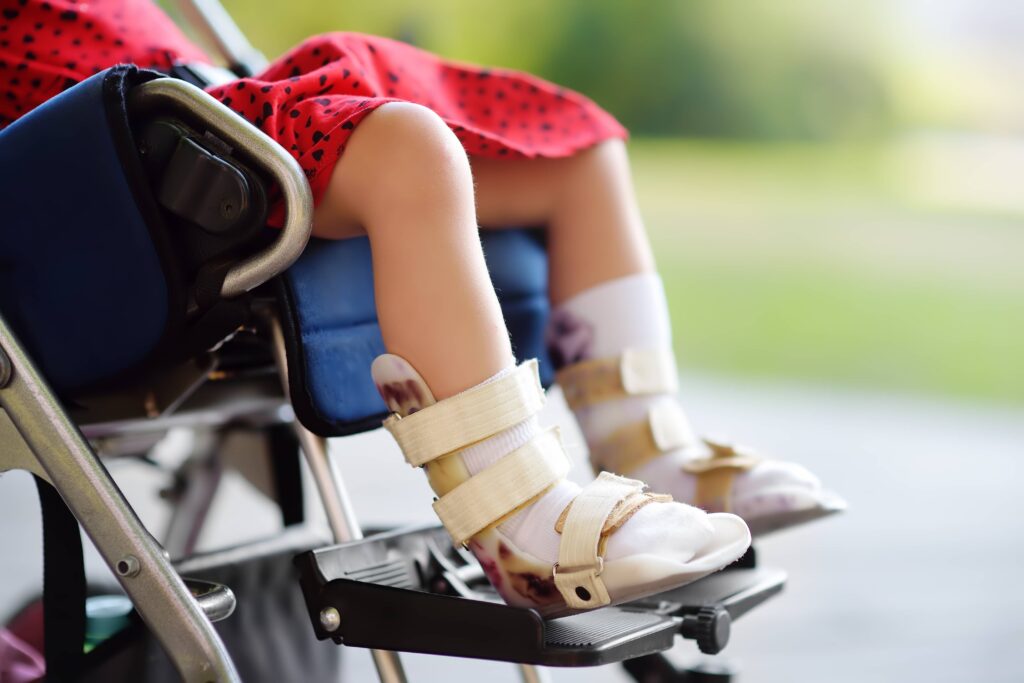 child with cerebral palsy caused by a birth injury in wheelchair