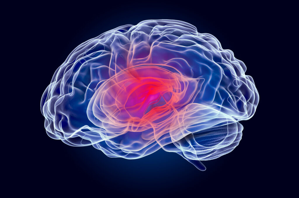  lesiones cerebrales traumáticas