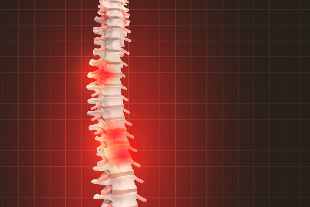 Abogados de lesiones de la columna vertebral en Las Vegas