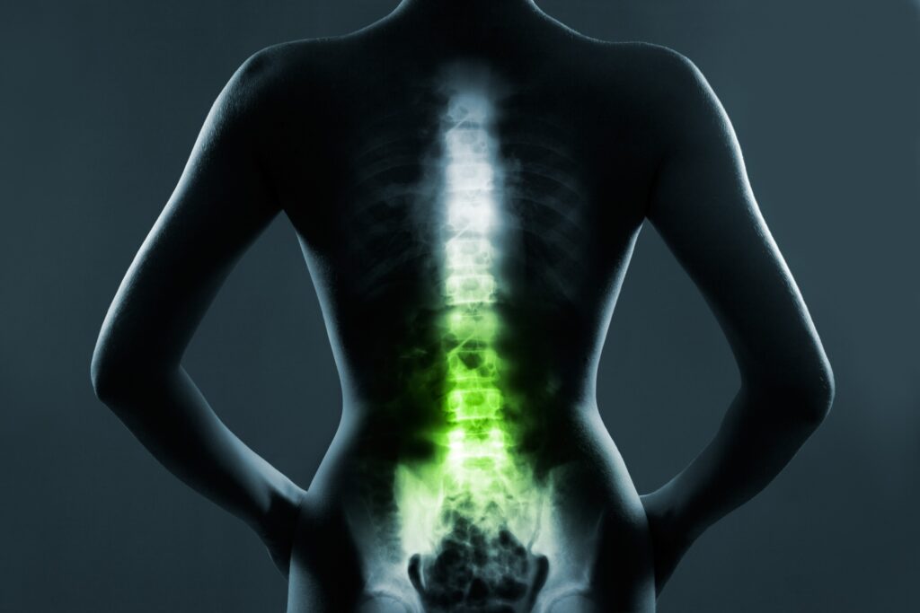  Summerlin Spinal Injury Attorneys