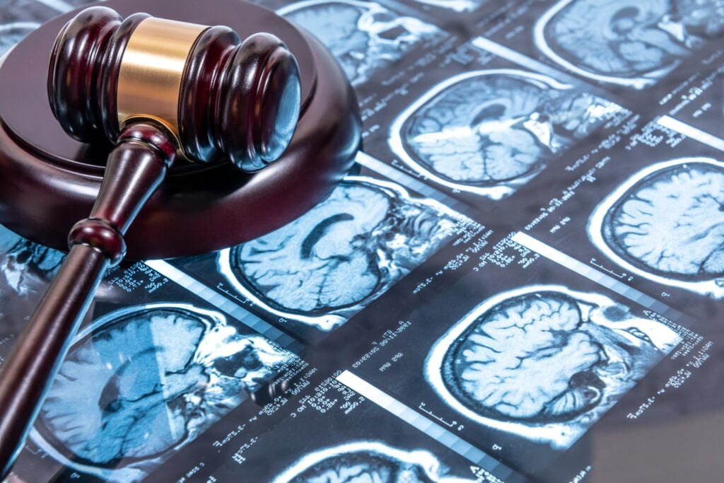 Valparaiso Brain Injury Lawyers