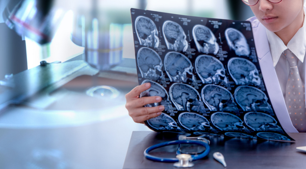 Mes de concientización sobre las lesiones cerebrales: cinco datos que debe saber