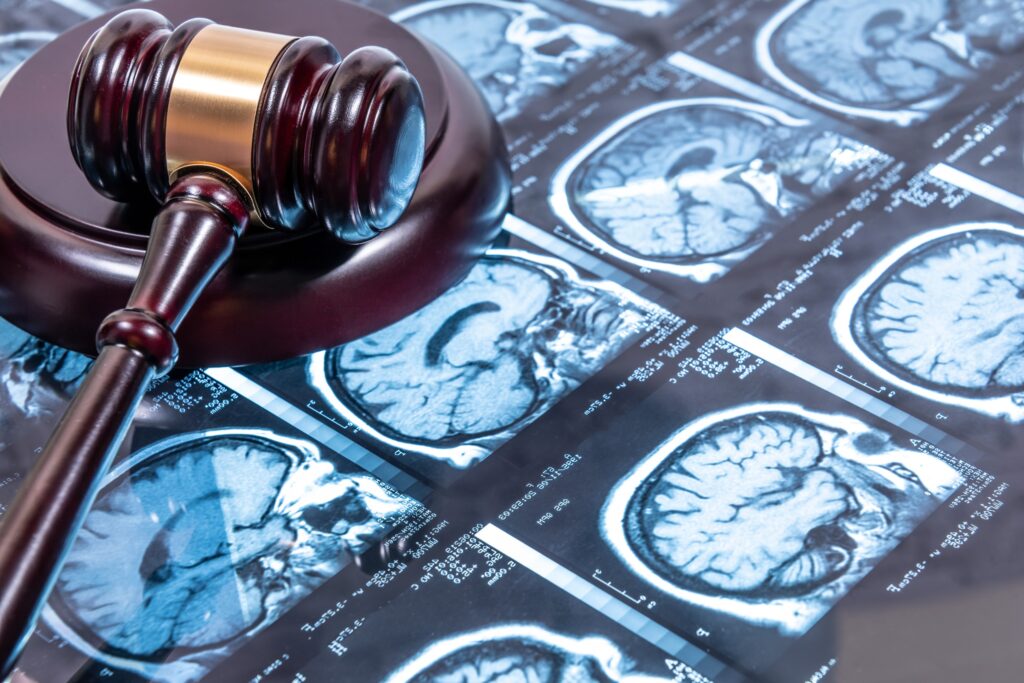 Abogado de lesiones cerebrales en Reno, Nevada