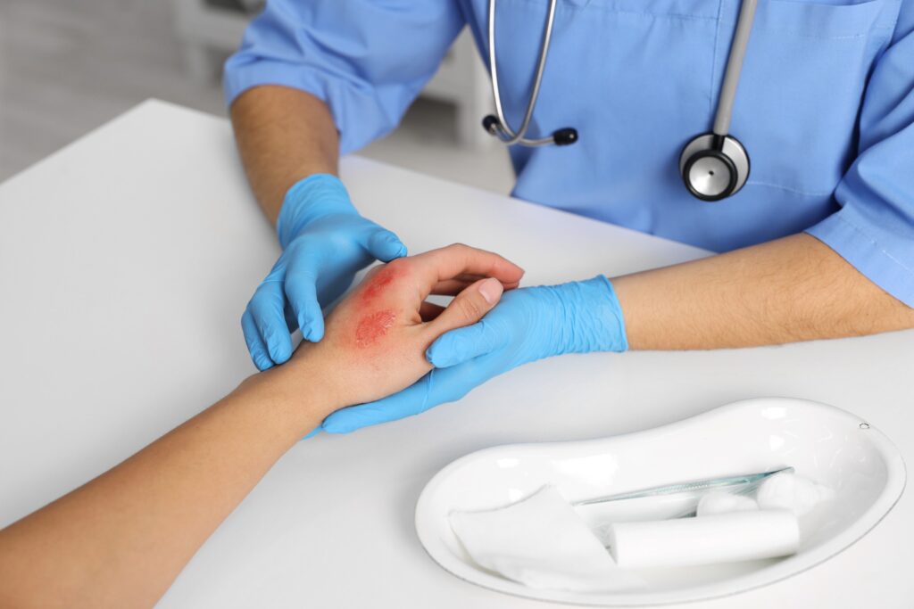 Gilbert Burn Injury Lawyer