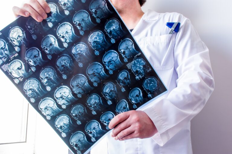 Elgin Brain Injury Lawyer