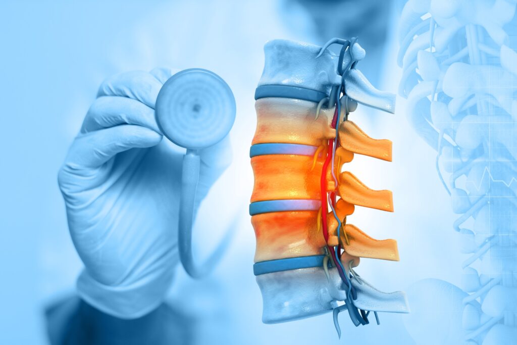 Gilbert Spinal Injury Lawyer