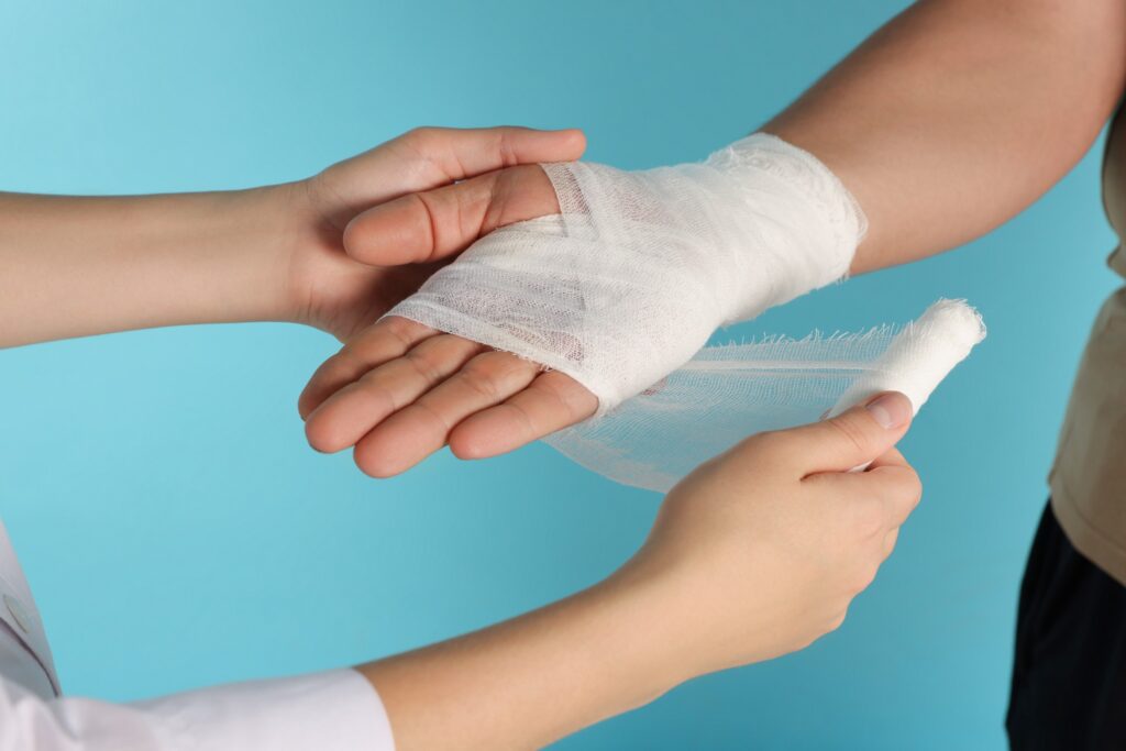Glendale Burn Injury Lawyer