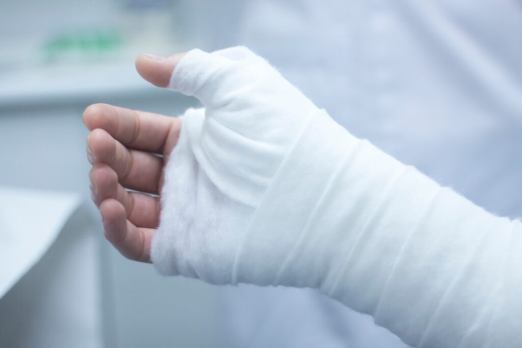 North Las Vegas Burn Injuries Lawyer