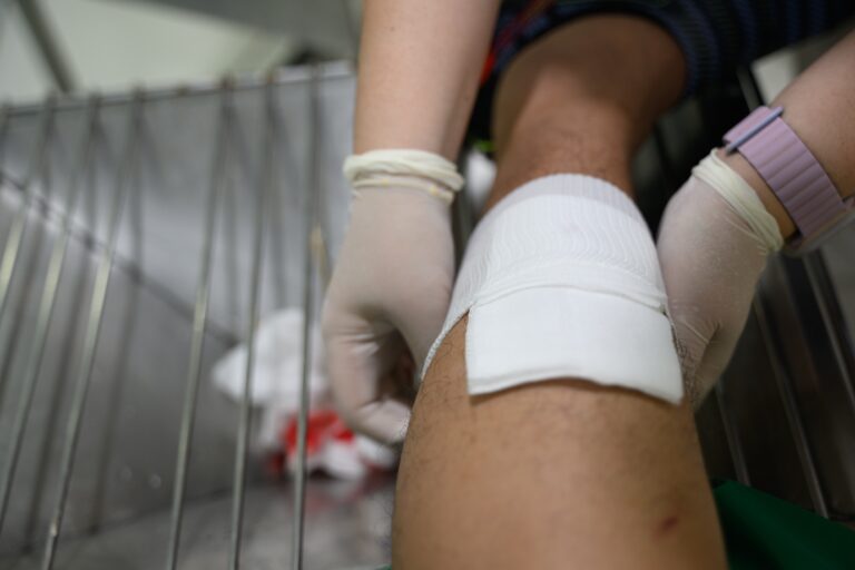 Mesa Burn Injuries Lawyer