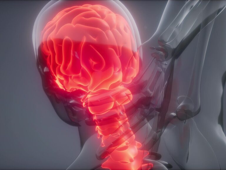 Mesa Whiplash Injury Lawyer