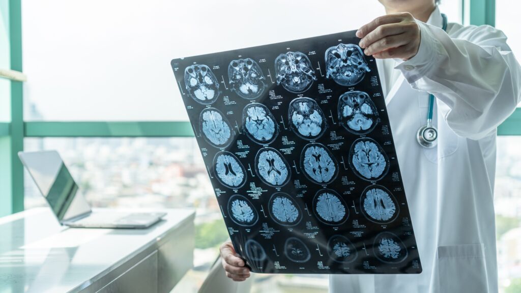 Arrowhead Brain Injury Lawyers 