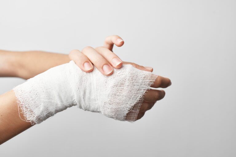 Los Lunas Burn Injuries Lawyer