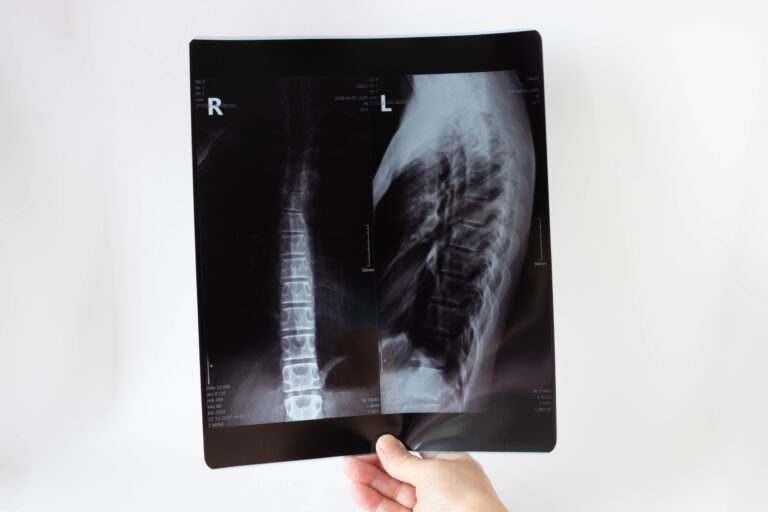 Los Lunas Spinal Injury Lawyer