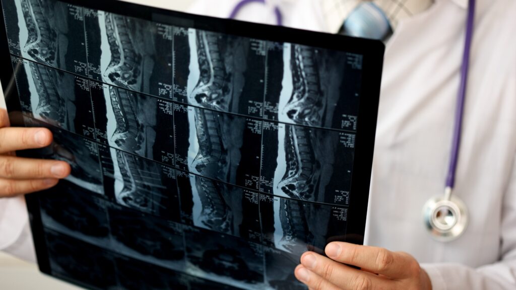 Pahrump Spinal Injury Lawyer