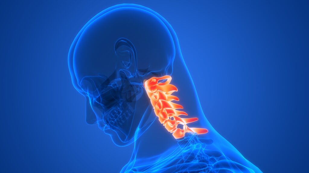 Abogados de latigazo cervical en Yuma 