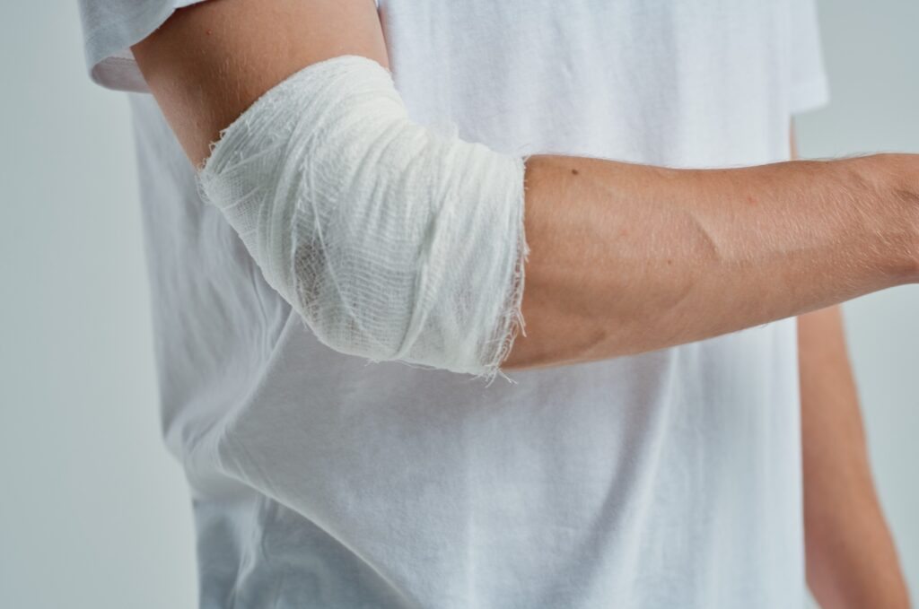 Sparks Burn Injuries Lawyer
