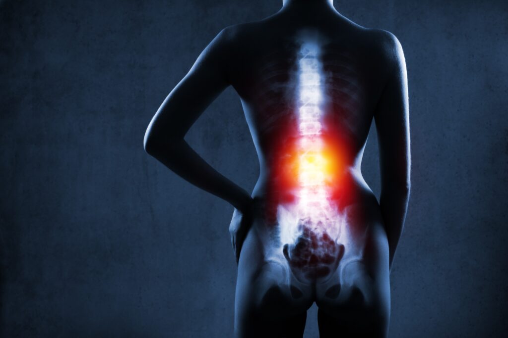 Abogados de lesiones de la columna vertebral en Sparks