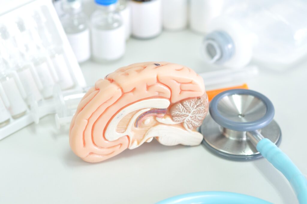 Tolleson Brain Injury Lawyer