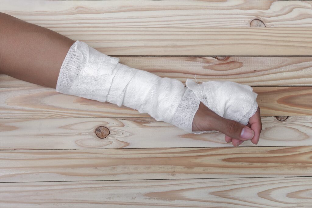 Tolleson Burn Injuries Lawyer