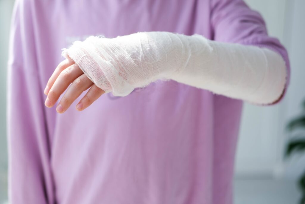 Cold Springs Burn Injuries Lawyer