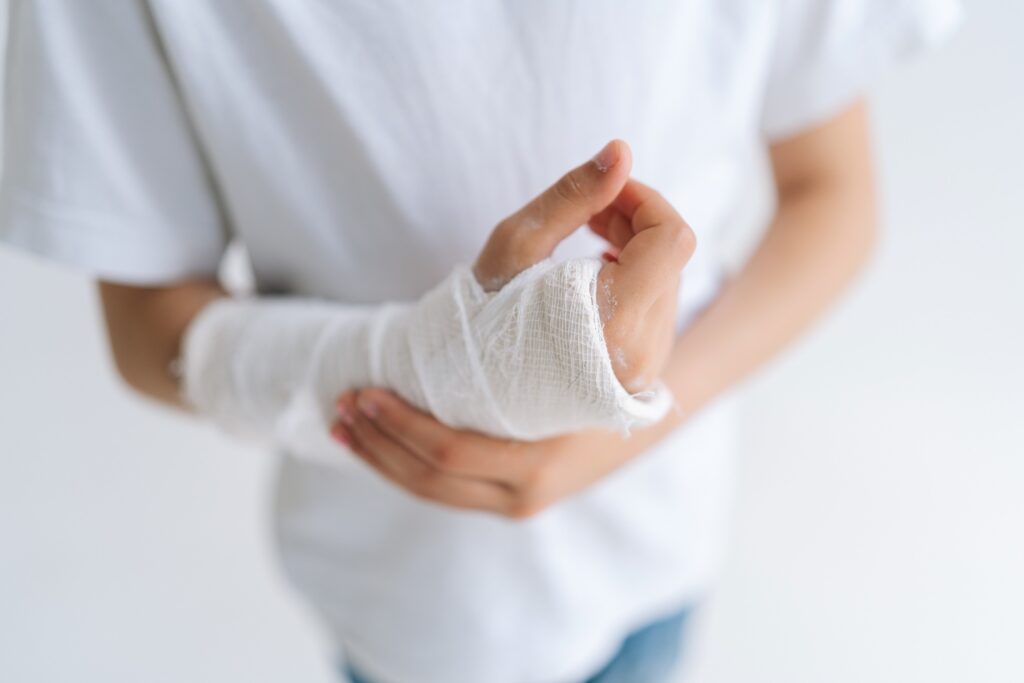 Elko Burn Injuries Lawyer
