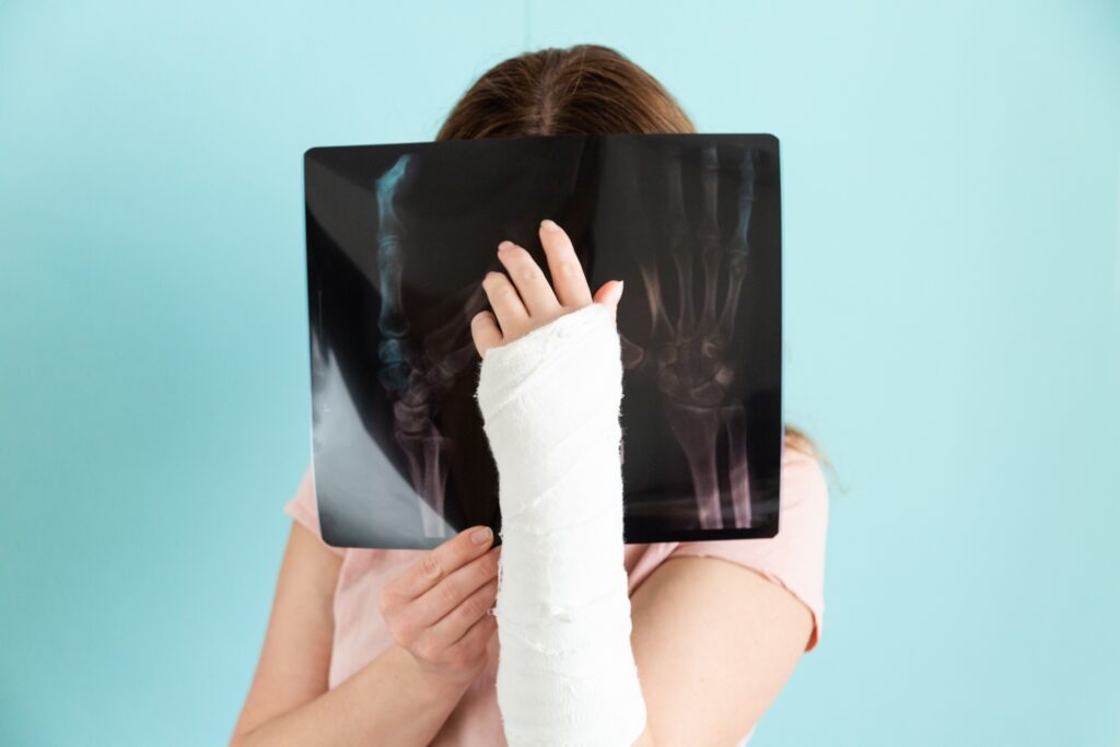 Fernley Bone Fractures Lawyer