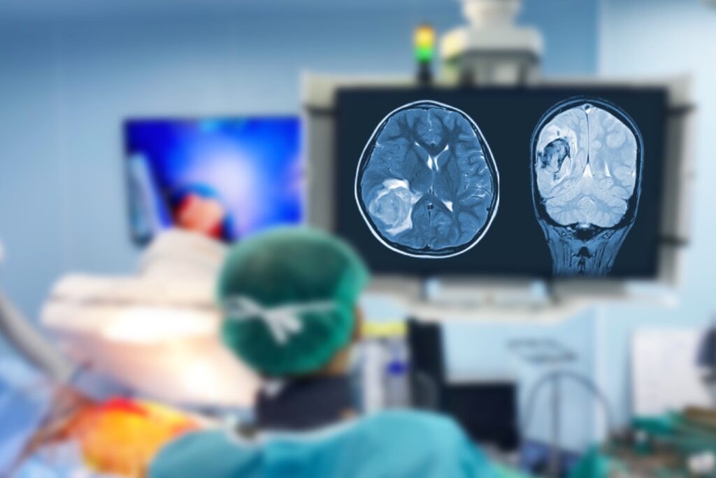 Fernley Brain Injury Lawyer