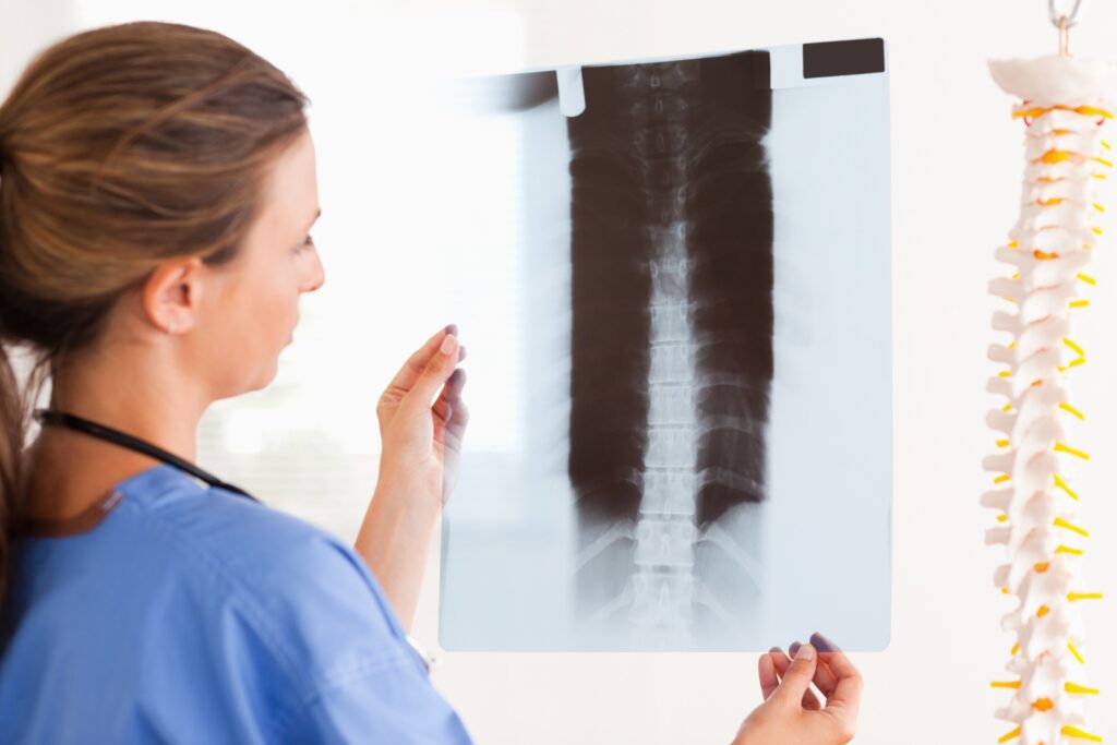 Fernley Spinal Injury Lawyer