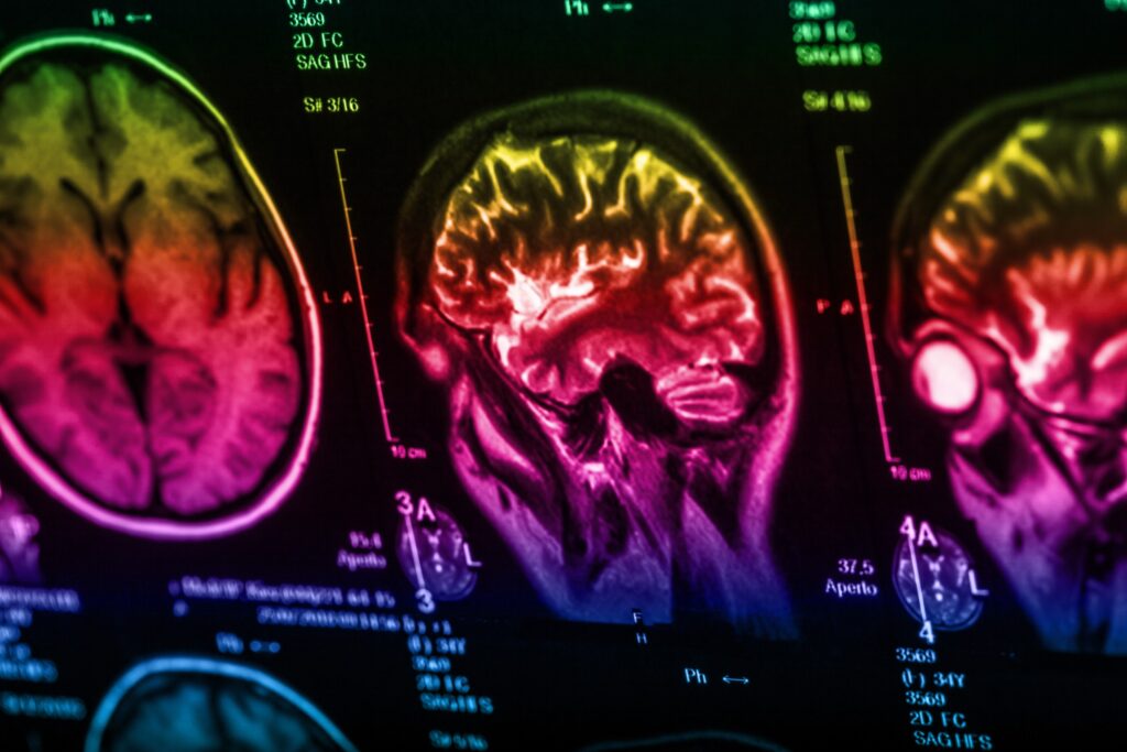 Winnemucca Brain Injury Lawyer
