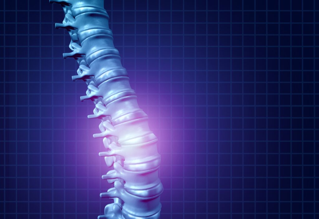 Winnemucca Spinal Injury Lawyer