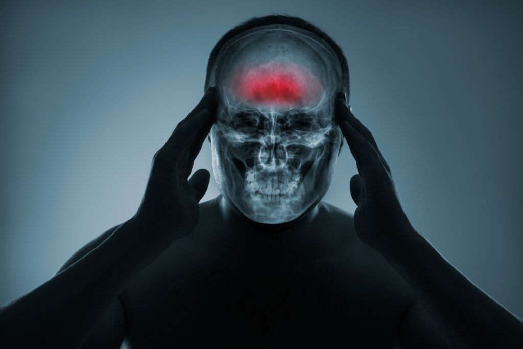 Abogados de lesiones cerebrales en Mesquite