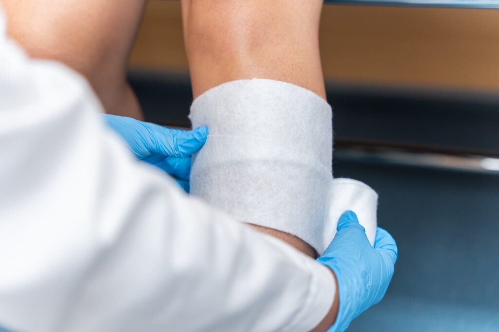 Washoe Valley Burn Injuries Lawyer