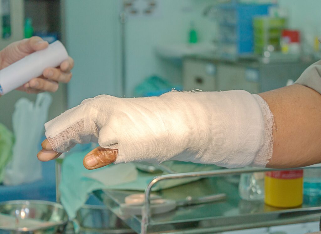 Dayton Burn Injuries Lawyer