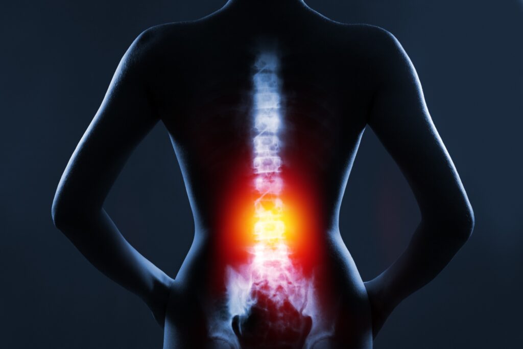 Dayton Spinal Injury Lawyer