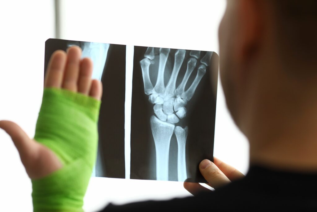 Las Cruces Bone Fractures Lawyer