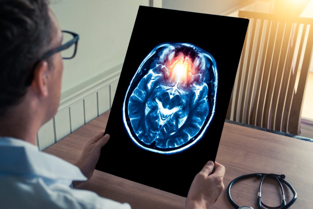 Las Cruces Brain Injury Lawyer