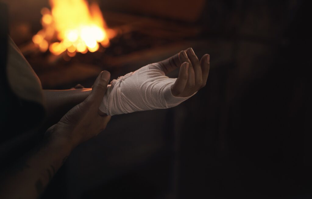 Las Cruces Burn Injuries Lawyer