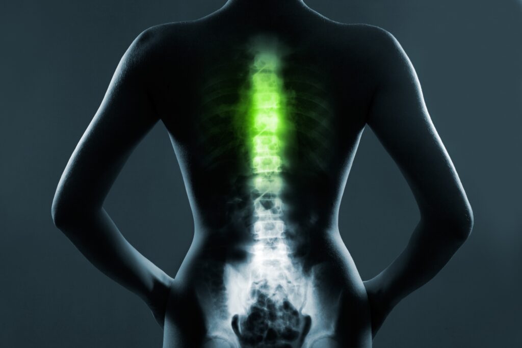 Las Cruces Spinal Injury Lawyer