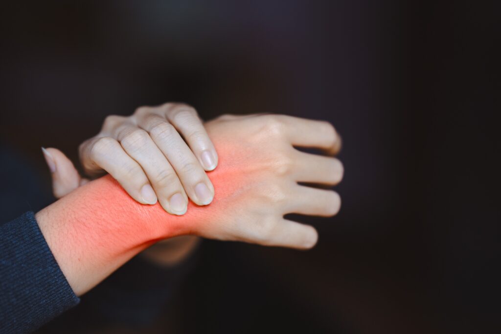 West Wendover Burn Injuries Lawyer
