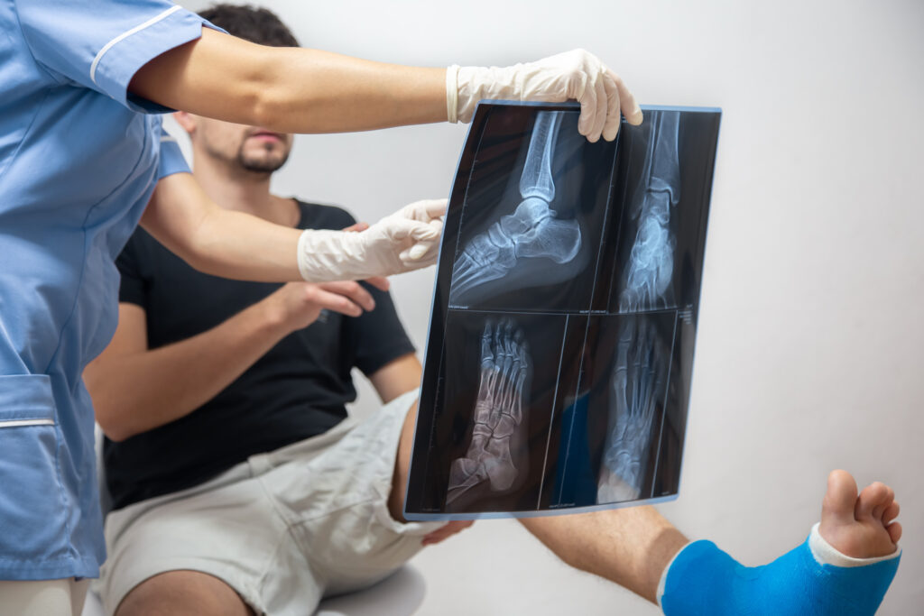 Hobbs Bone Fractures Lawyer