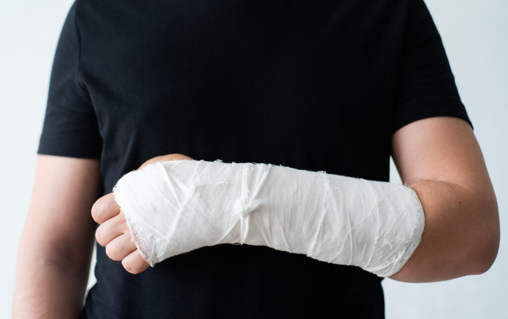 Roswell Bone Fractures Lawyer