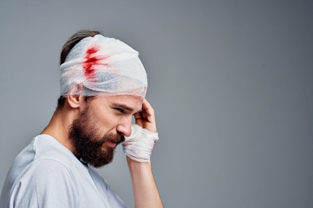 Santa Rosa Brain Injury Lawyers