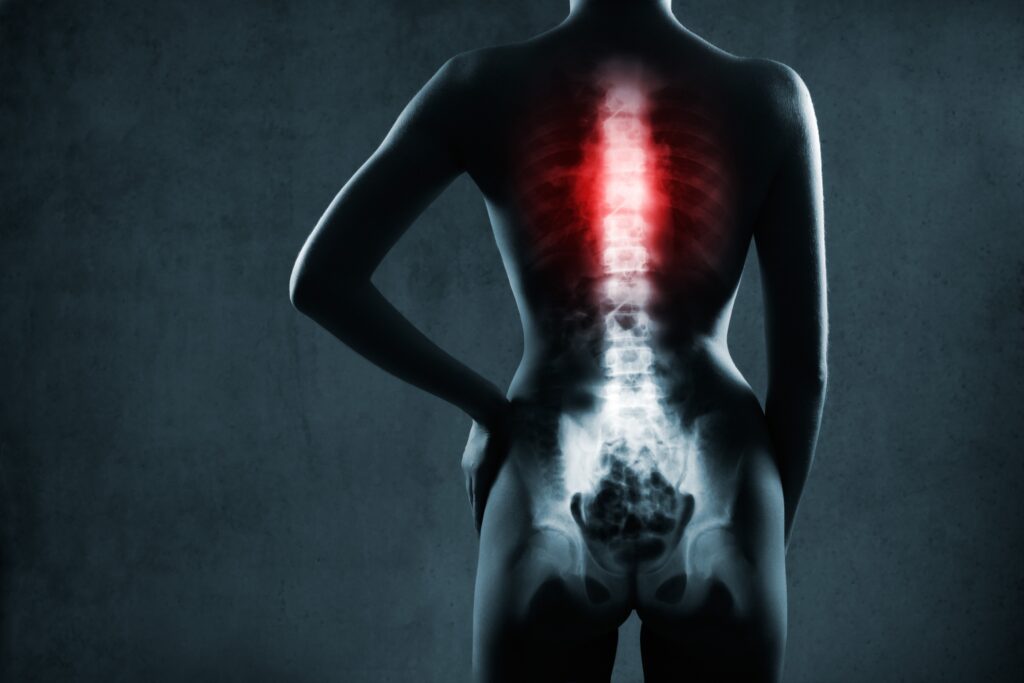 Santa Rosa Spinal Injury Lawyers