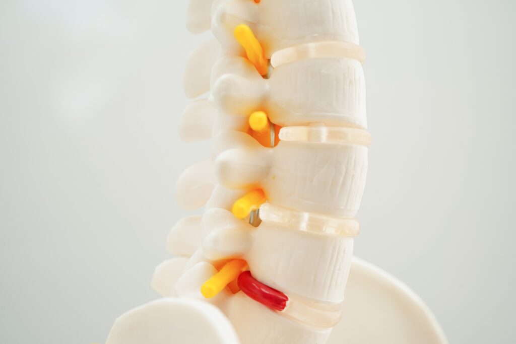 Silver Springs Spinal Injury Lawyer