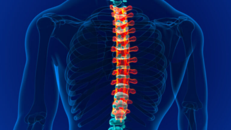 Abogados de lesiones de la columna vertebral en Houston 