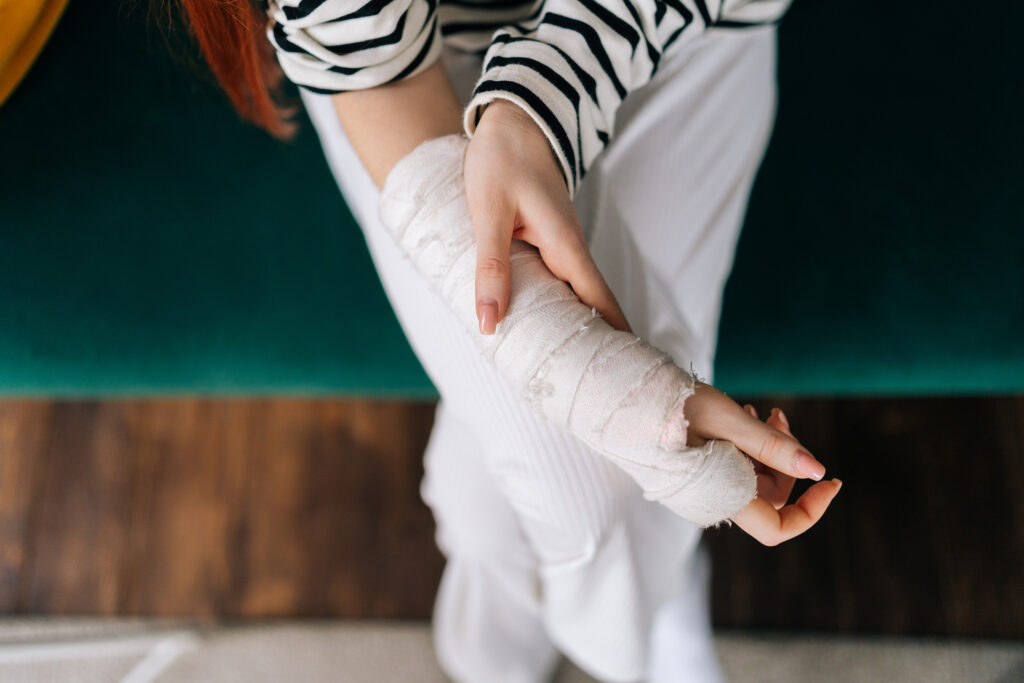 Hobbs Burn Injuries Lawyer