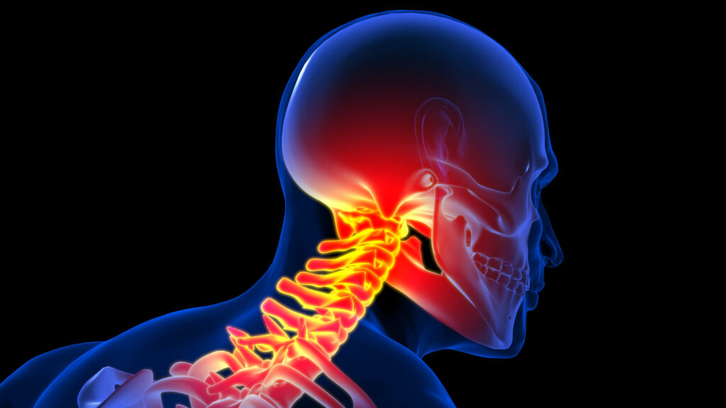 Crown Point Whiplash Injury Lawyer 